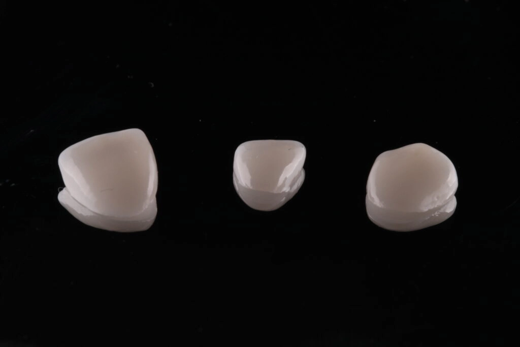 Carillas Dentales sin tallar