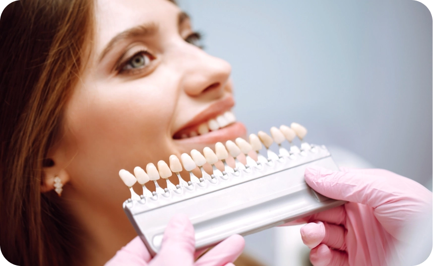 Carillas de composite | Tratamientos I.M Dental