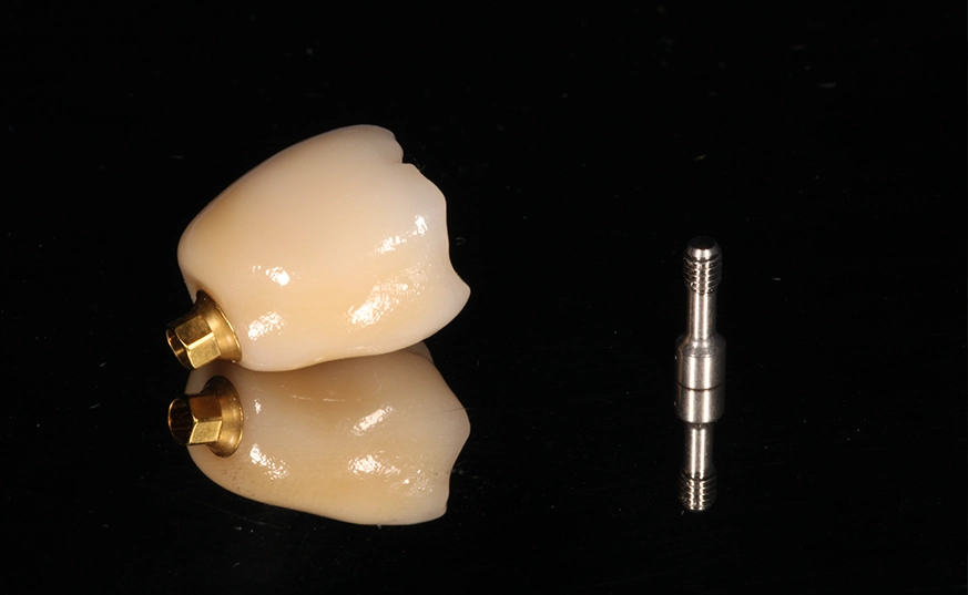 Implantes | I.M Dental