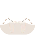 Periodoncia | I.M Dental